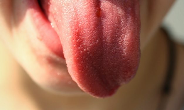 Hoe gezond ben jij? Kijk naar de kleur je tong!